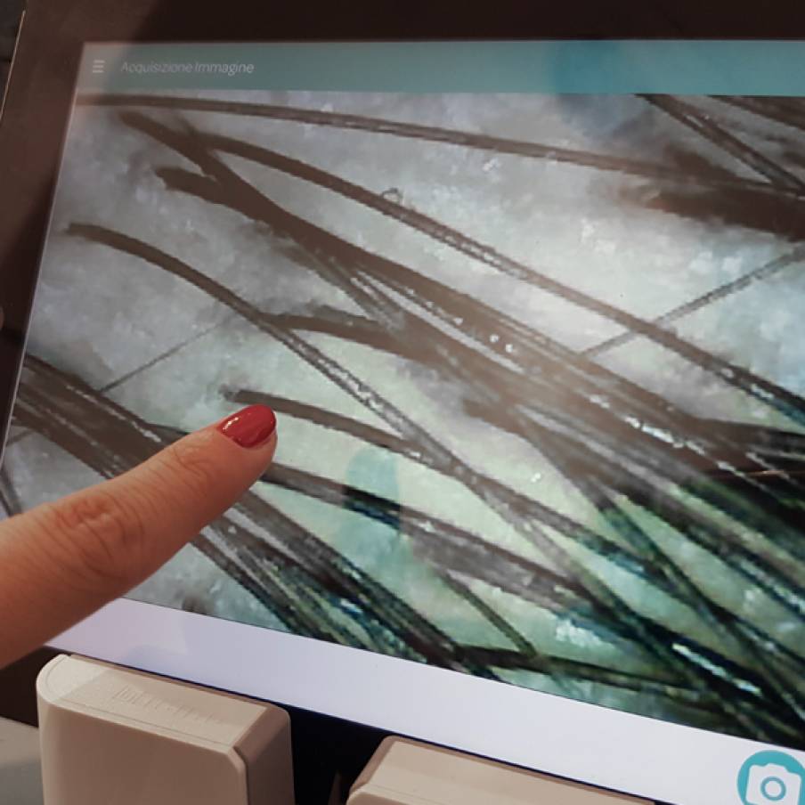 Analisi cute e capello con microcamera