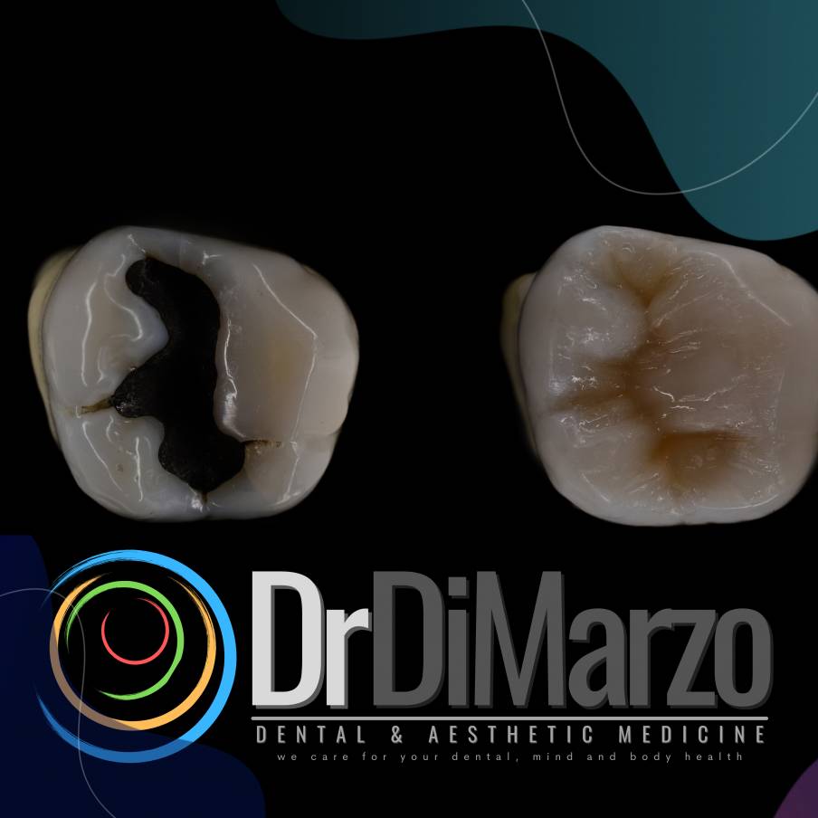 Odontoiatria Adesiva