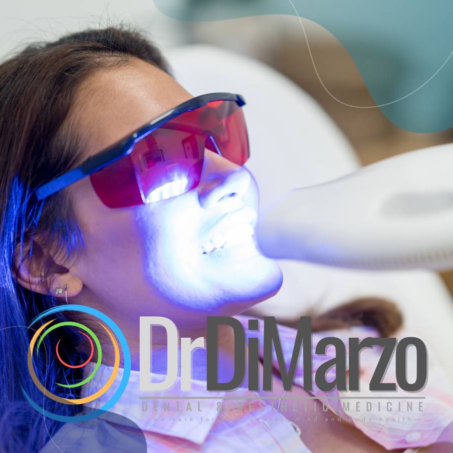 Sbiancamento professionale