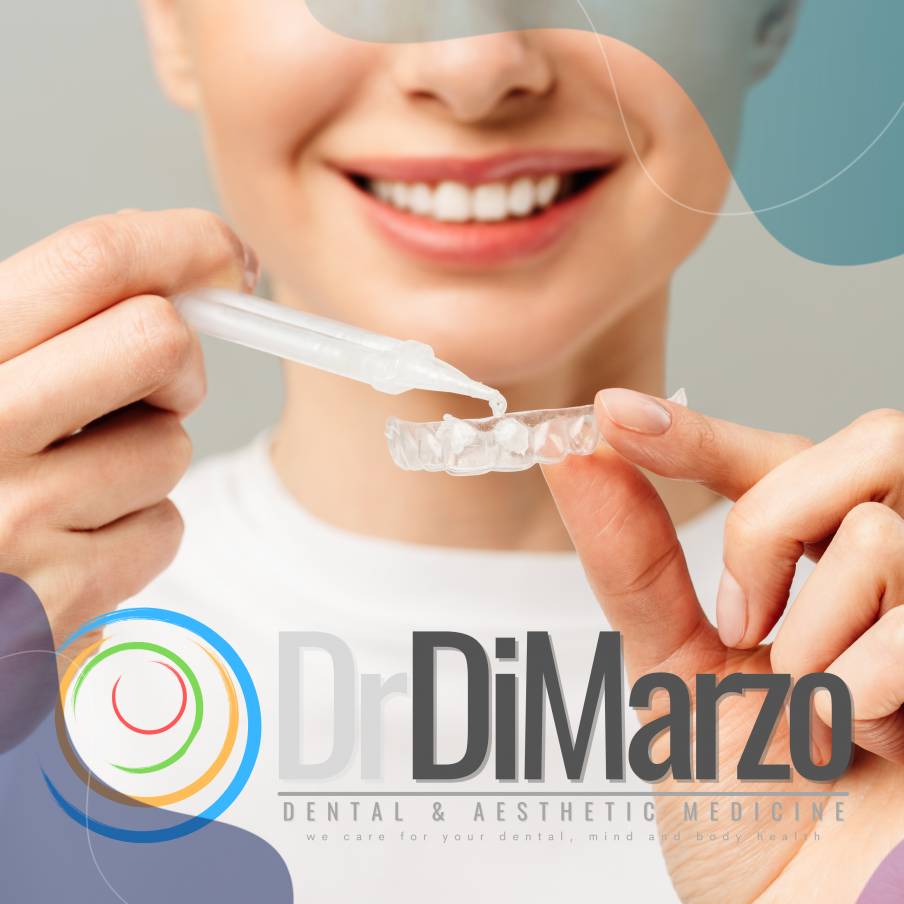 Sbiancamento professionale